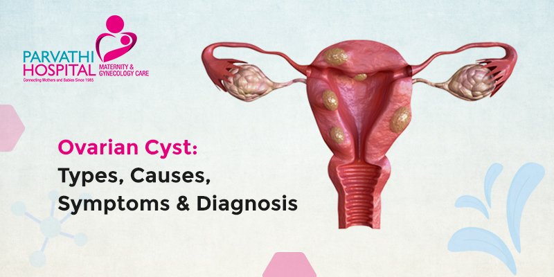 Ovarian Cyst: Types, Causes, Symptoms & Diagnosis