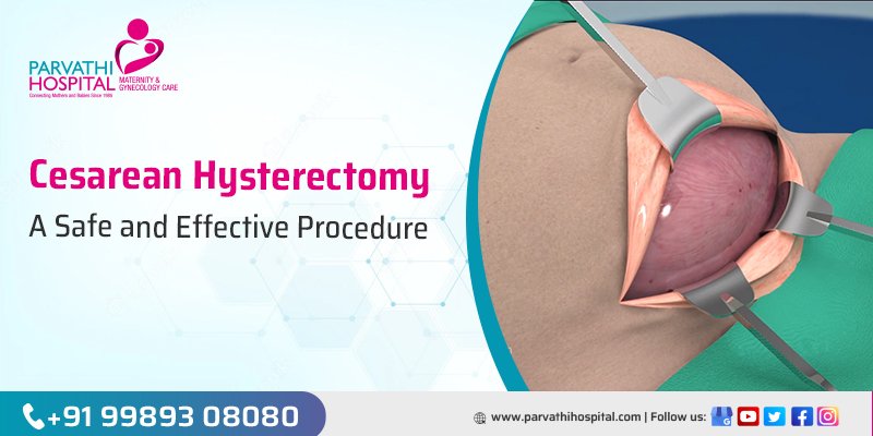 Safe and Effective Procedure for Cesarean Hysterectomy